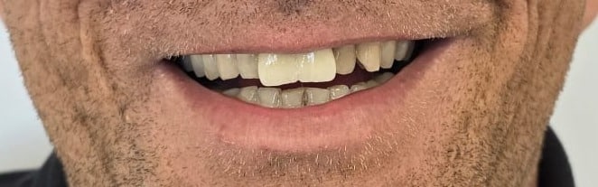 9a 9a